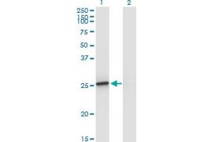 Western Blot analysis of AMELX expression in transfected 293T cell line by AMELX monoclonal antibody (M02A), clone 5B2. (AMELX 抗体  (AA 93-191))