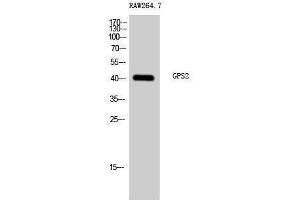 Western Blotting (WB) image for anti-G Protein Pathway Suppressor 2 (GPS2) (N-Term) antibody (ABIN3184920) (GPS2 抗体  (N-Term))