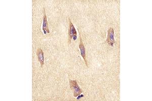 (ABIN652309 and ABIN2841413) staining NPTX1 in human brain tissue sections by Immunohistochemistry (IHC-P - paraformaldehyde-fixed, paraffin-embedded sections).