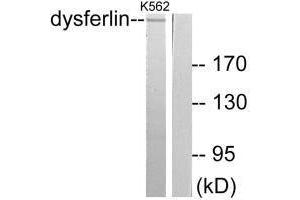 Western blot analysis of extracts from K562 cells, using Dysferlin antibody. (Dysferlin 抗体)