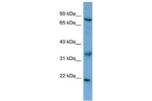 WB Suggested Anti-ABCD2 Antibody Titration: 0. (CCL17 抗体  (N-Term))