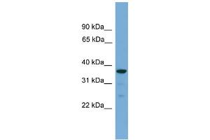 WB Suggested Anti-HAPLN2 Antibody Titration: 0.
