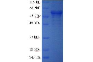 SDS-PAGE (SDS) image for Calreticulin (CALR) (AA 18-416) protein (GST tag) (ABIN5709181) (Calreticulin Protein (CALR) (AA 18-416) (GST tag))