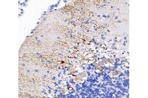 Immunohistochemistry (Paraffin-embedded Sections) (IHC (p)) image for anti-Spectrin, Beta, Non-erythrocytic 2 (SPTBN2) antibody (ABIN7075698)