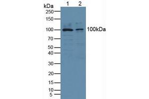 Western blot analysis of (1) Human HeLa cells and (2) Human PC-3 Cells. (PLA2G4A 抗体  (AA 563-749))