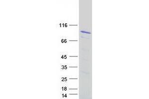 Western Blotting (WB) image for Zyxin (ZYX) (Transcript Variant 1) protein (Myc-DYKDDDDK Tag) (ABIN2736196)