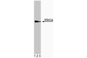 Western blot analysis of NMT-2 on human endothelial lysate. (NMT2 抗体  (AA 10-119))