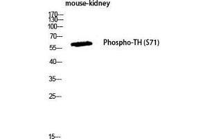 Western Blot (WB) analysis of Mouse Kidney lysis using Phospho-TH (S71) antibody. (TH 抗体  (pSer71))