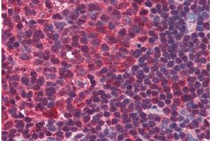 Human Colon, Lymphoid Follicle (formalin-fixed, paraffin-embedded) stained with PRDM1 antibody ABIN351445 at 3 ug/ml followed by biotinylated goat anti-rabbit IgG secondary antibody ABIN481713, alkaline phosphatase-streptavidin and chromogen. (PRDM1 抗体  (C-Term))