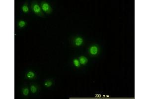 Immunofluorescence of monoclonal antibody to STK38 on HeLa cell. (STK38 抗体  (AA 1-465))