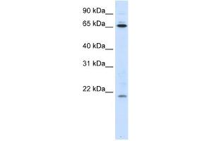 WB Suggested Anti-NIP7 Antibody Titration:  0. (NIP7 抗体  (Middle Region))