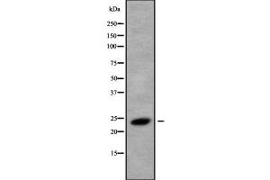 Western blot analysis of RAB8B using HeLa whole cell lysates (RAB8B 抗体  (C-Term))
