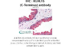Image no. 1 for anti-Kelch-Like 15 (KLHL15) (C-Term) antibody (ABIN1736246) (KLHL15 抗体  (C-Term))