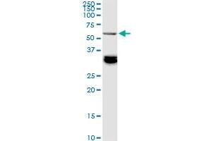 BAIAP2L1 monoclonal antibody (M01), clone 2A4. (BAIAP2L1 抗体  (AA 398-511))