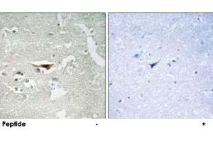 Immunohistochemistry analysis of paraffin-embedded human brain tissue, using PKIB polyclonal antibody . (PKIB 抗体)