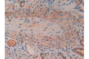 DAB staining on IHC-P; Samples: Rat Stomach Tissue (SMAD1 抗体  (AA 273-468))