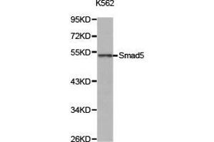Western Blotting (WB) image for anti-SMAD, Mothers Against DPP Homolog 5 (SMAD5) antibody (ABIN1874856) (SMAD5 抗体)