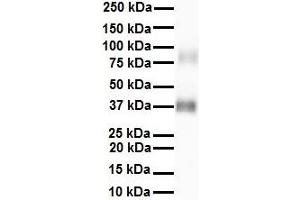 WB Suggested Anti-RNF2 antibody Titration: 1 ug/mL Sample Type: Human Heart (RNF2 抗体  (Middle Region))