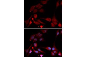 Immunofluorescence analysis of U2OS cells using APBB1 antibody (ABIN5971004). (FE65 抗体)