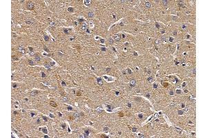 ABIN6258265 and ABIN6273489 at 1/100 staining rat brain tissue by IHC-P. (MAPK11 抗体  (C-Term))
