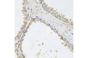 Immunohistochemistry of paraffin-embedded human prostate using POMGNT1 antibody. (POMGNT1 抗体)