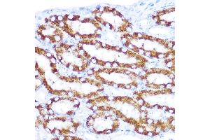 Immunohistochemistry of paraffin-embedded mouse kidney using TNFRSF10D Rabbit pAb (ABIN6127587, ABIN6149306, ABIN6149308 and ABIN6221737) at dilution of 1:100 (40x lens). (DcR2 抗体  (AA 257-386))