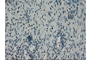 Image no. 1 for anti-NIMA (Never in Mitosis Gene A)-Related Kinase 6 (NEK6) antibody (ABIN1499686) (NEK6 抗体)