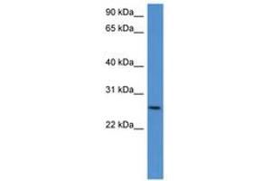 Image no. 1 for anti-Chondrolectin (CHODL) (AA 161-210) antibody (ABIN6746374) (CHODL 抗体  (AA 161-210))