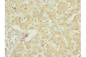 Immunohistochemistry of paraffin-embedded human liver tissue using ABIN7154146 at dilution of 1:100 (GLYCTK 抗体  (AA 284-523))