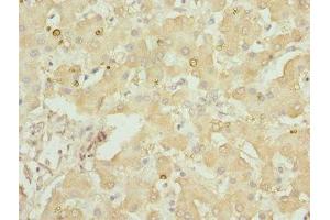 Immunohistochemistry of paraffin-embedded human liver tissue using ABIN7154146 at dilution of 1:100