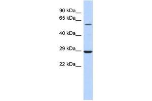 LPCAT1 antibody used at 1 ug/ml to detect target protein. (LPCAT1 抗体  (Middle Region))