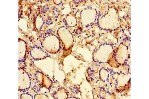 Immunohistochemistry of paraffin-embedded human thyroid tissue using ABIN7157298 at dilution of 1:100 (KLHL38 抗体  (AA 1-200))
