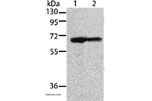 Western blot analysis of 293T and A431 cell, using MSN Polyclonal Antibody at dilution of 1:500 (Moesin 抗体)
