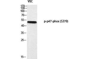 Western Blot (WB) analysis of VEC using p-p47-phox (S370) antibody. (NCF1 抗体  (pSer370))