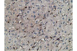 Immunohistochemical staining of paraffin-embedded Human liver tissue using anti-RBP1 mouse monoclonal antibody. (RBP1 抗体)