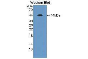 Detection of Recombinant IL12Rb1, Mouse using Polyclonal Antibody to Interleukin 12 Receptor Beta 1 (IL12Rb1) (IL12RB1 抗体  (AA 197-348))