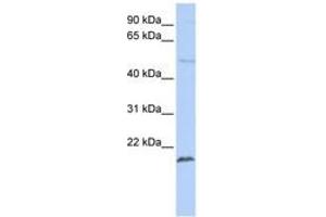 Image no. 1 for anti-Zinc Finger Protein 79 (ZNF79) (N-Term) antibody (ABIN6740442) (ZNF79 抗体  (N-Term))