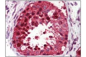 Immunohistochemistry: USP2 antibody staining of Formalin-Fixed, Paraffin-Embedded Human Testis. (USP2 抗体  (C-Term))