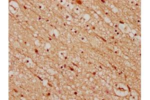 IHC image of ABIN7148739 diluted at 1:200 and staining in paraffin-embedded human brain tissue performed on a Leica BondTM system. (CELF4 抗体  (AA 120-236))
