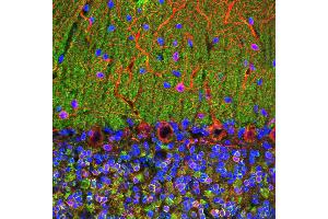 Confocal image of adult rat cerebellum stained with VILIP / VSNL1 antibody (green), chicken polyclonal antibody to MAP2(red) and DNA (blue). (VSNL1 抗体)