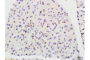 Formalin-fixed and paraffin embedded rat pancreas labeled with Anti-Prohibitin Polyclonal Antibody, Unconjugated (ABIN686692) at 1:200 followed by conjugation to the secondary antibody and DAB staining. (Prohibitin 抗体  (AA 171-272))