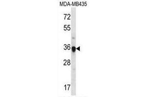 Western blot analysis in MDA-MB435 cell line lysates (35ug/lane) using FGL1 Antibody (C-term).