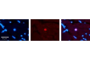 Rabbit Anti-RING1 Antibody Catalog Number: ARP33228_P050 Formalin Fixed Paraffin Embedded Tissue: Human heart Tissue Observed Staining: Nucleus Primary Antibody Concentration: 1:100 Other Working Concentrations: N/A Secondary Antibody: Donkey anti-Rabbit-Cy3 Secondary Antibody Concentration: 1:200 Magnification: 20X Exposure Time: 0. (RING1 抗体  (Middle Region))