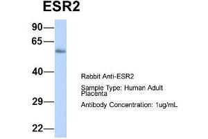 Host:  Rabbit  Target Name:  ESR2  Sample Type:  Human Adult Placenta  Antibody Dilution:  1. (ESR2 抗体  (N-Term))