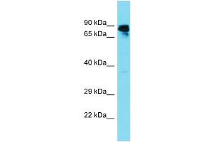 Host: Rabbit Target Name: GBP6 Sample Type: Fetal Liver lysates Antibody Dilution: 1. (GBP6 抗体  (N-Term))