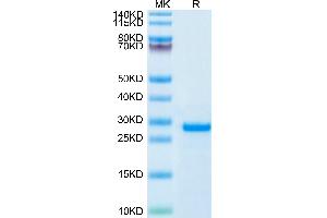 Human PS20 on Tris-Bis PAGE under reduced condition. (WFDC1 Protein (AA 32-220) (His tag))