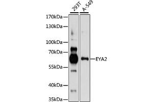 Western blot analysis of extracts of various cell lines, using EY antibody (ABIN7267072) at 1:1000 dilution. (EYA2 抗体  (AA 300-400))