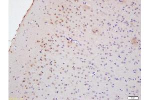 Formalin-fixed and paraffin embedded rat brain labeled with Anti-Myelin PLP Polyclonal Antibody, Unconjugated  at 1:200 followed by conjugation to the secondary antibody and DAB staining (PLP1 抗体  (AA 21-120))