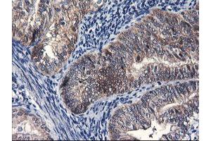 Image no. 8 for anti-F-Box Protein 21 (FBXO21) antibody (ABIN1498231) (FBXO21 抗体)