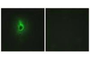 Immunofluorescence analysis of HeLa cells, using Collagen VI α3 antibody. (COL6a3 抗体)